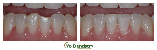 nguyenorthodontics012008.jpg