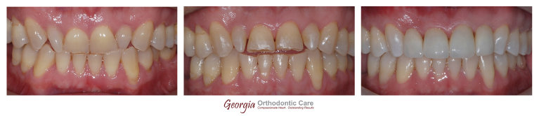 nguyenorthodontics012009.jpg
